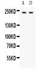 Anti-Otoferlin Antibody