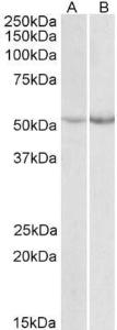 Anti-PAH antibody