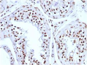 Immunohistochemical analysis of formalin-fixed, paraffin-embedded human testicular carcinoma using Anti-Histone H1 Antibody [1415-1]