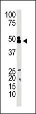 Anti-CBX8 Rabbit Polyclonal Antibody