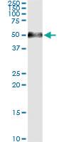 Anti-AGER Mouse Monoclonal Antibody [clone: 1C1]