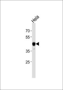 Anti-NFIC Rabbit Polyclonal Antibody (HRP (Horseradish Peroxidase))