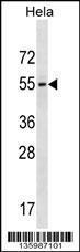 Anti-GALR3 Rabbit Polyclonal Antibody (AP (Alkaline Phosphatase))