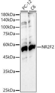 Western blot analysis of various lysates, using Anti-NR2F2 Antibody (A8562) at 1:700 dilution. The secondary antibody was Goat Anti-Rabbit IgG H&L Antibody (HRP) at 1:10,000 dilution. Lysates/proteins were present at 25µg per lane.