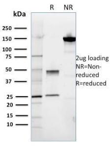 Anti-ROR2 Mouse Monoclonal Antibody [clone: ROR2/1911]