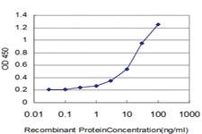 Anti-AGER Mouse Monoclonal Antibody [clone: 1C1]