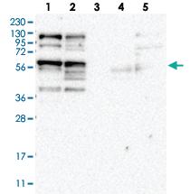 Anti-PHACTR4 Rabbit Polyclonal Antibody