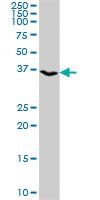 Anti-KLF8 Rabbit Polyclonal Antibody