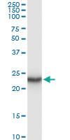 Anti-GUK1 Polyclonal Antibody Pair