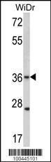 Anti-Connexin 31, CT, C241 Rabbit Polyclonal Antibody (FITC (Fluorescein))