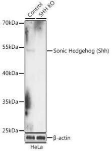 Western blot analysis of extracts from normal (control) and Sonic Hedgehog (Sonic Hedgehog (Shh)) knockout (KO) HeLa cells, using Anti-Sonic Hedgehog Antibody (A92955) at 1:1000 dilution. The secondary Antibody was Goat Anti-Rabbit IgG H&L Antibody (HRP) at 1:10000 dilution.