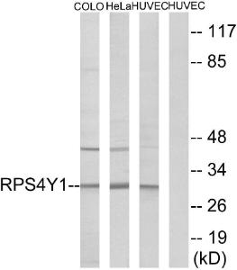 Western blot analysis of lysates from HUVEC, HeLa, and COLO cells using Anti-RPS4Y1 Antibody. The right hand lane represents a negative control, where the antibody is blocked by the immunising peptide.