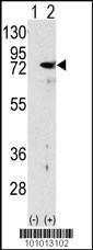 Anti-PRKCD Rabbit Polyclonal Antibody (HRP (Horseradish Peroxidase))