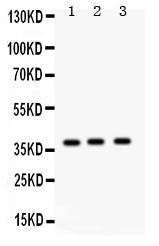 Anti-Surfactant Protein D Antibody