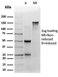 SDS-PAGE analysis of Anti-ZNF358 Antibody [PCRP-ZNF358-1A6] under non-reduced and reduced conditions; showing intact IgG and intact heavy and light chains, respectively. SDS-PAGE analysis confirms the integrity and purity of the antibody