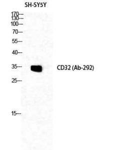 Western blot analysis of SH SY5Y cells using Anti-CD32 Antibody