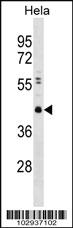 Anti-CBX8 Rabbit Polyclonal Antibody