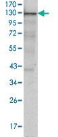 Anti-JAK3 Mouse Monoclonal Antibody [clone: 5H2]