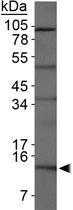 Anti-S100 A12 Rabbit Polyclonal Antibody