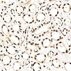 Immunohistochemistry analysis of paraffin-embedded human kidney using Anti-NR2F2 Antibody (A8562) at a dilution of 1:50 (40x lens). Perform high pressure antigen retrieval with 10 mM citrate buffer pH 6.0 before commencing with IHC staining protocol.