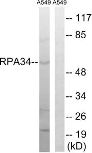 Western blot analysis of lysates from A549 cells using Anti-CD3EAP Antibody. The right hand lane represents a negative control, where the antibody is blocked by the immunising peptide