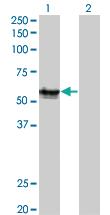 Anti-AGER Mouse Monoclonal Antibody [clone: 1C1]