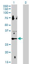 Anti-HSD11B1 Rabbit Polyclonal Antibody