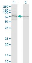 Anti-ZDHHC8 Mouse Monoclonal Antibody [clone: 1C5]