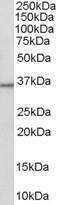 Anti-HSD11B1 Antibody (A83256) (0.3 µg/ml) staining of Human Liver lysate (35 µg protein in RIPA buffer). Primary incubation was 1 hour. Detected by chemilu minescence