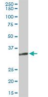 Anti-HSD11B1 Rabbit Polyclonal Antibody