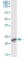 Anti-GUK1 Antibody Pair