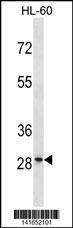 Anti-FAM110D Rabbit Polyclonal Antibody (AP (Alkaline Phosphatase))