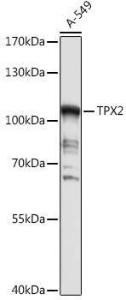 Western blot analysis of extracts of A-549 cells, using Anti-TPX2 Antibody (A307828) at 1:1,000 dilution. The secondary antibody was Goat Anti-Rabbit IgG H&L Antibody (HRP) at 1:10,000 dilution.