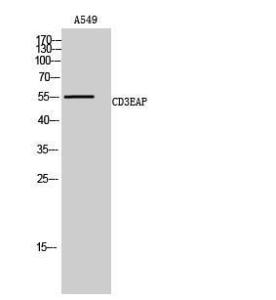 Western blot analysis of A549 cells using Anti-CD3EAP Antibody