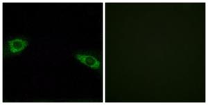 Immunofluorescence analysis of HUVEC cells using Anti-RPS4Y1 Antibody. The right hand panel represents a negative control, where the antibody was pre-incubated with the immunising peptide.