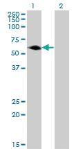 Anti-AGER Mouse Monoclonal Antibody [clone: 1D1]