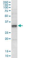 Anti-HSD11B1 Mouse Monoclonal Antibody [clone: 2C10]