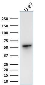 Anti-Vimentin antibody