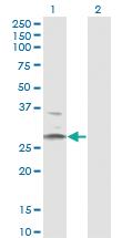 Anti-HSD11B1 Mouse Monoclonal Antibody [clone: 2C10]