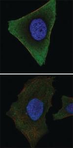 Anti-JAK3 Mouse Monoclonal Antibody [clone: 5H2]