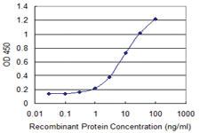 Anti-FIP1L1 Mouse Monoclonal Antibody [clone: 2H4]