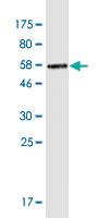 Anti-PNP Mouse Monoclonal Antibody [clone: 6E5]