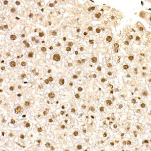 Immunohistochemistry analysis of paraffin-embedded mouse liver using Anti-NR2F2 Antibody (A8562) at a dilution of 1:50 (40x lens). Perform high pressure antigen retrieval with 10 mM citrate buffer pH 6.0 before commencing with IHC staining protocol.