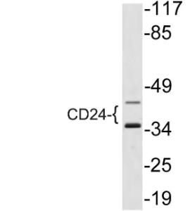 Western blot analysis of lysate from NIH/3T3 cells using Anti-CD24 Antibody