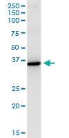 Anti-HSD11B1 Mouse Monoclonal Antibody [clone: 2C10]