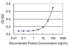 Anti-ACRC Mouse Monoclonal Antibody [clone: 2E4]