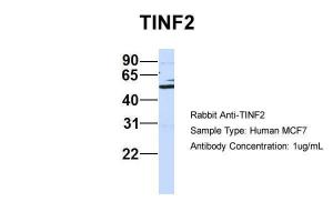 Anti-TINF2 Rabbit Polyclonal Antibody