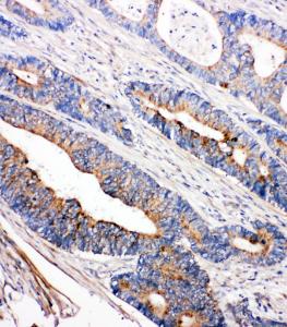 Anti-Tec Rabbit Polyclonal Antibody