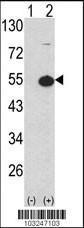 Anti-PRKAR1A Rabbit Polyclonal Antibody