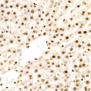 Immunohistochemistry analysis of paraffin-embedded rat liver using Anti-NR2F2 Antibody (A8562) at a dilution of 1:50 (40x lens). Perform high pressure antigen retrieval with 10 mM citrate buffer pH 6.0 before commencing with IHC staining protocol.